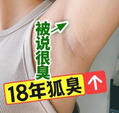 香体露分享大测评 改善狐臭选对产品很重要