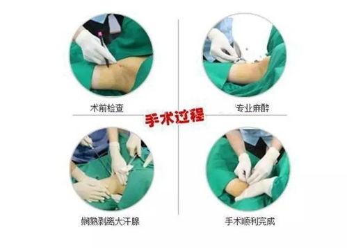 它让你害怕坐车 约会 工作,你还不行动吗